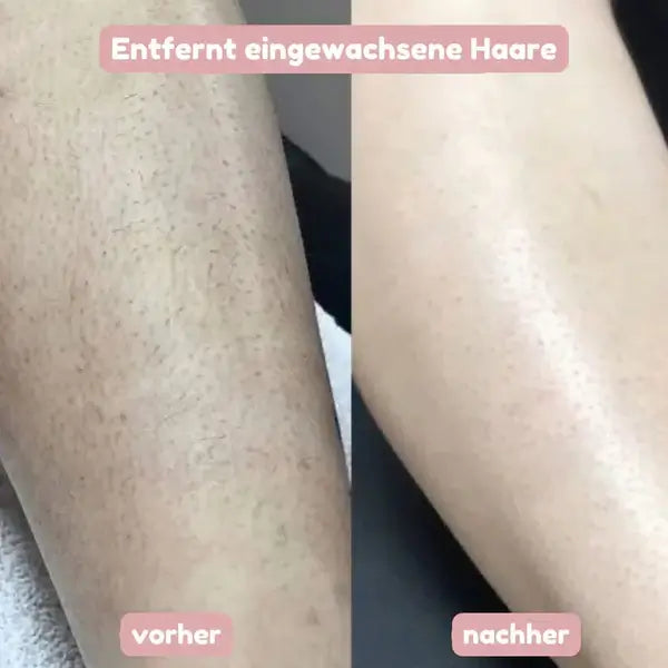 SeidenGlanz | 2 in 1 Damenrasierer für glatte und gepflegte Haut