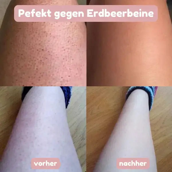 SeidenGlanz | 2 in 1 Damenrasierer für glatte und gepflegte Haut