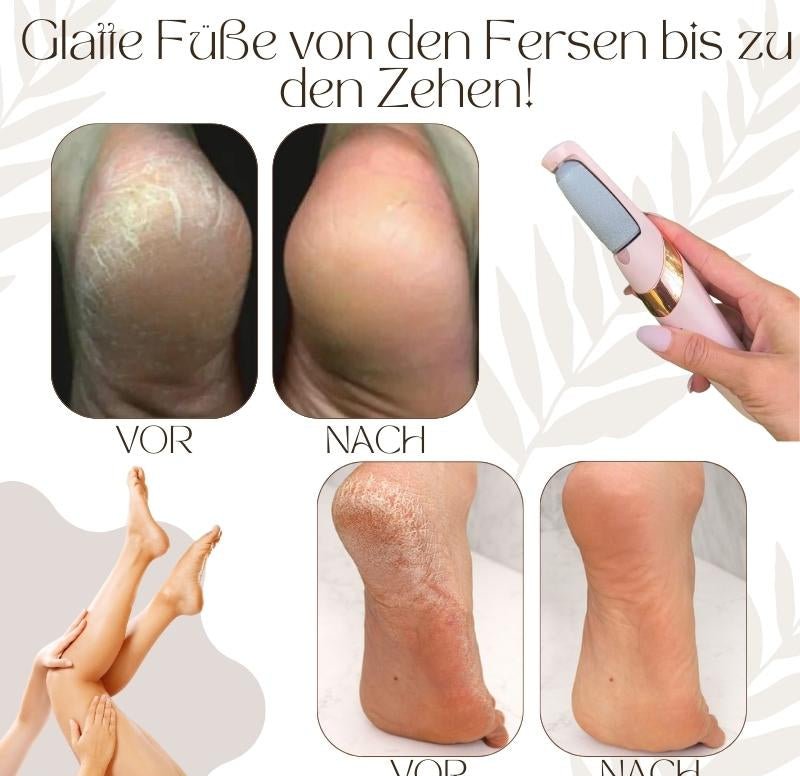 Callusos – Elektrischer Hornhautentferner