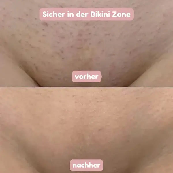 SeidenGlanz | 2 in 1 Damenrasierer für glatte und gepflegte Haut