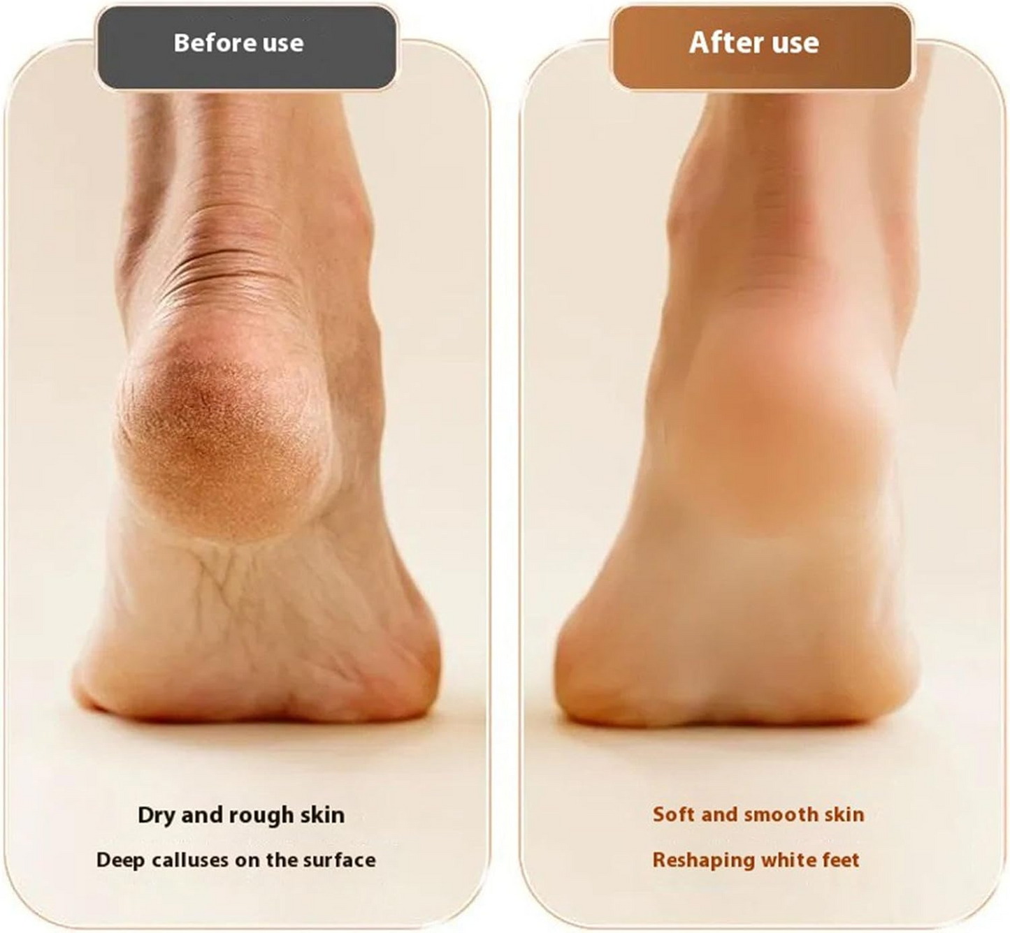 Elektrische Fußpflege | Glatte Füße zu Hause